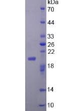Mouse FGF22 Protein (Recombinant His-T7)