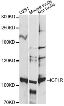 Polyclonal Rabbit anti-Human IGF1R / IGF1 Receptor Antibody (WB)