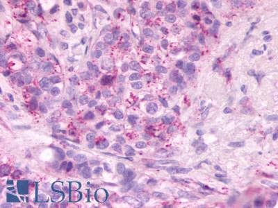 IHC-plus™ Polyclonal Rabbit anti-Human SIPR2 / S1P2 / EDG5 Antibody (C-Terminus, IHC)