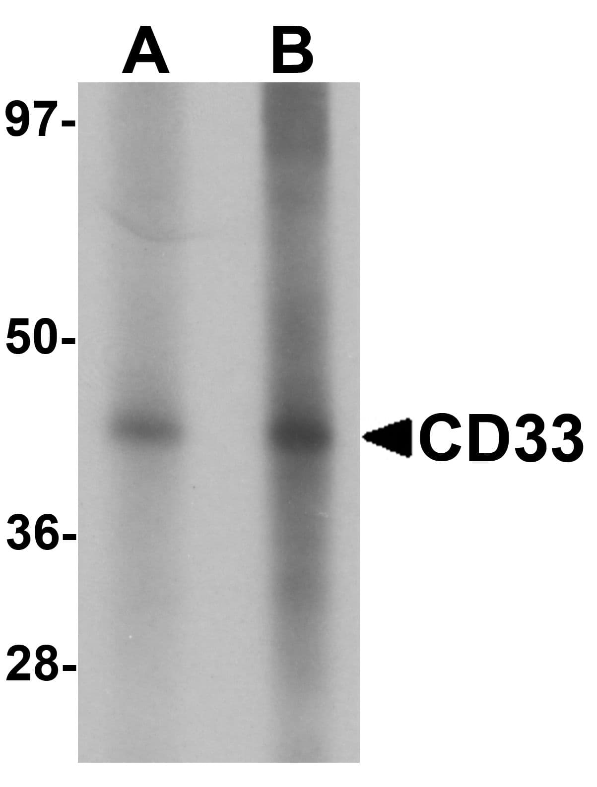 Polyclonal Rabbit anti-Human CD33 Antibody (WB)