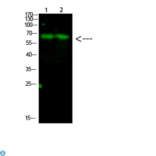Polyclonal Rabbit anti-Human CDC73 / Parafibromin Antibody (WB)