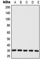 Polyclonal Rabbit anti-Human MRPL28 Antibody (Internal, WB)