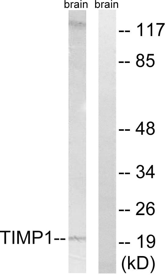Polyclonal Rabbit anti-Human TIMP1 Antibody (aa61-110, WB)