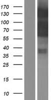 MYOCD / Myocardin Protein (Over-Expression Lysate Myc-DDK (Flag))