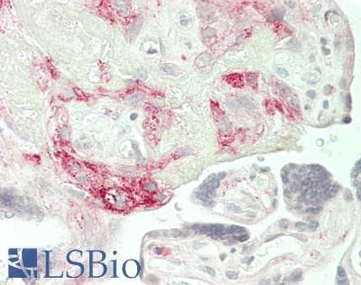 IHC-plus™ IL7 Antibody