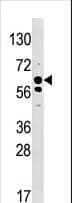 SYK Antibody (phospho-Tyr525/Tyr526)
