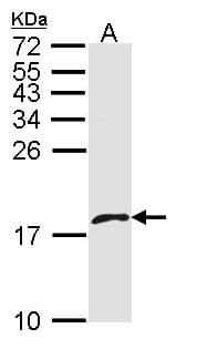 Polyclonal Rabbit anti-Human PF4V1 Antibody (aa40-104, IHC, WB)