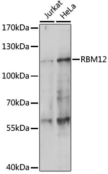 Polyclonal Rabbit anti-Human RBM12 Antibody (WB)