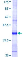 Human NOT1 / CNOT1 Protein (Recombinant GST, N-terminus)