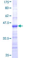 Human CORO1A / Coronin 1a Protein (Recombinant GST, N-terminus)