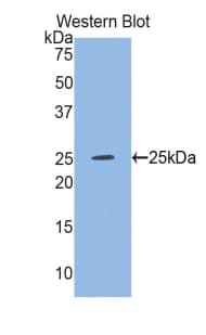 GSS / Glutathione Synthetase Antibody (aa268-474)