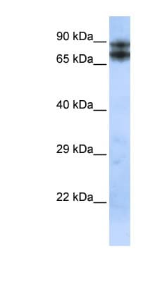 EPLIN Antibody (aa143-192)