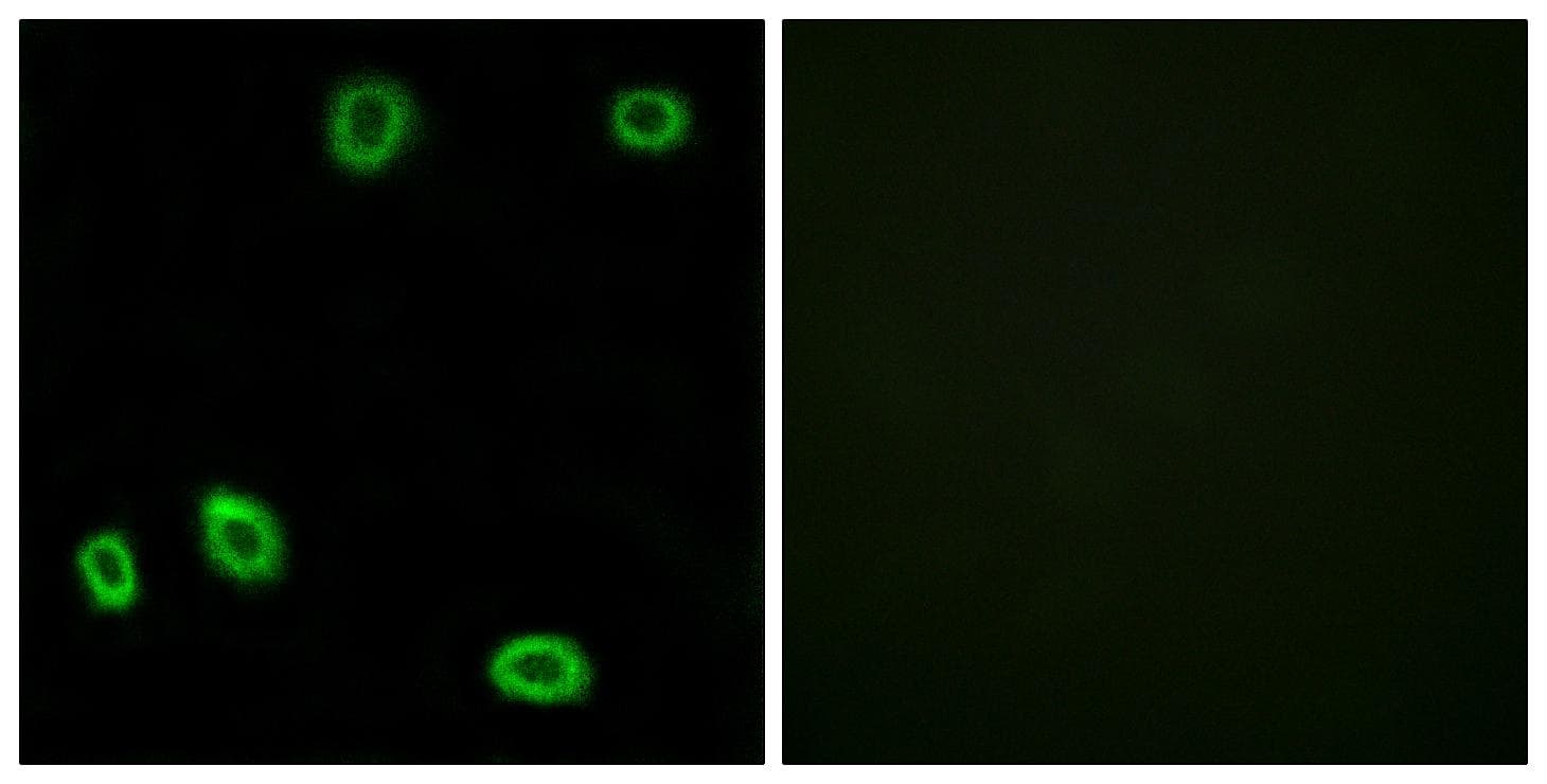 OR5L1+2 Antibody