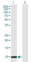 TMSB4Y Antibody (clone 6G4)