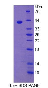 Mouse PDGF-CC Protein (Recombinant His-T7)