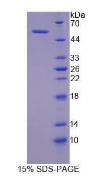 Human MYLK Protein (Recombinant His)