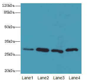 CA3 / Carbonic Anhydrase III Antibody