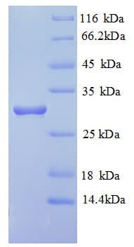 Human HLA-DRB1 Protein (Recombinant His)