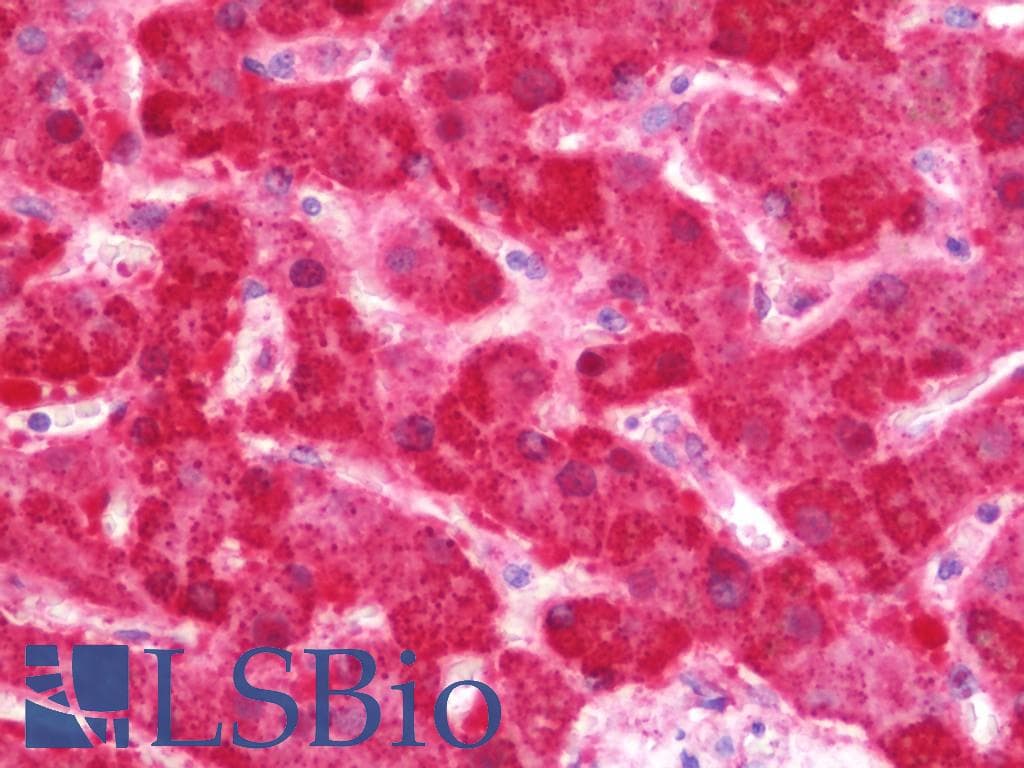 IHC-plus™ FH / Fumarase / MCL Antibody (aa89-365)