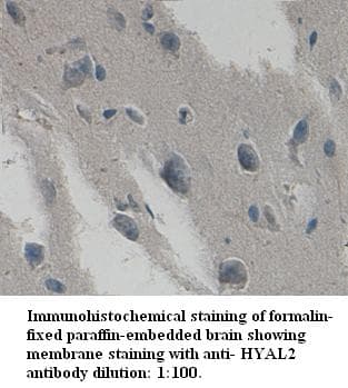 Polyclonal Rabbit anti-Human HYAL2 Antibody (C-Terminus, IHC)