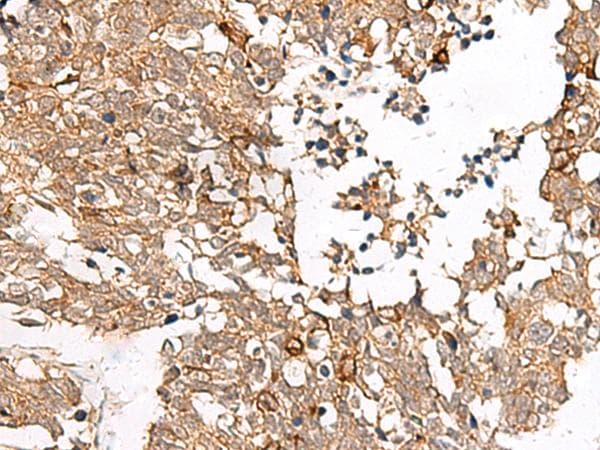 Polyclonal Rabbit anti-Human FAM84B Antibody (IHC, WB)