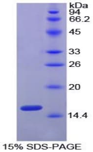 Chicken HIF1A / HIF1 Alpha Protein (Recombinant His)