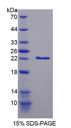 Rat CDKN1A / WAF1 / p21 Protein (Recombinant His-S)