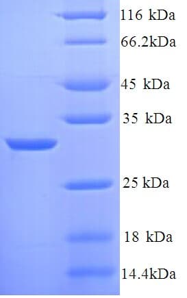 Rat KNG1 / Kininogen / Bradykinin Protein (Recombinant His)