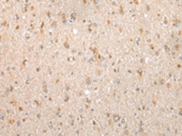 Polyclonal Rabbit anti-Human FKBP7 Antibody (IHC, WB)