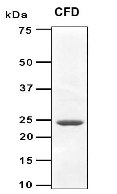 Human CFD / Factor D / Adipsin Protein (Recombinant 6His, N-terminus)
