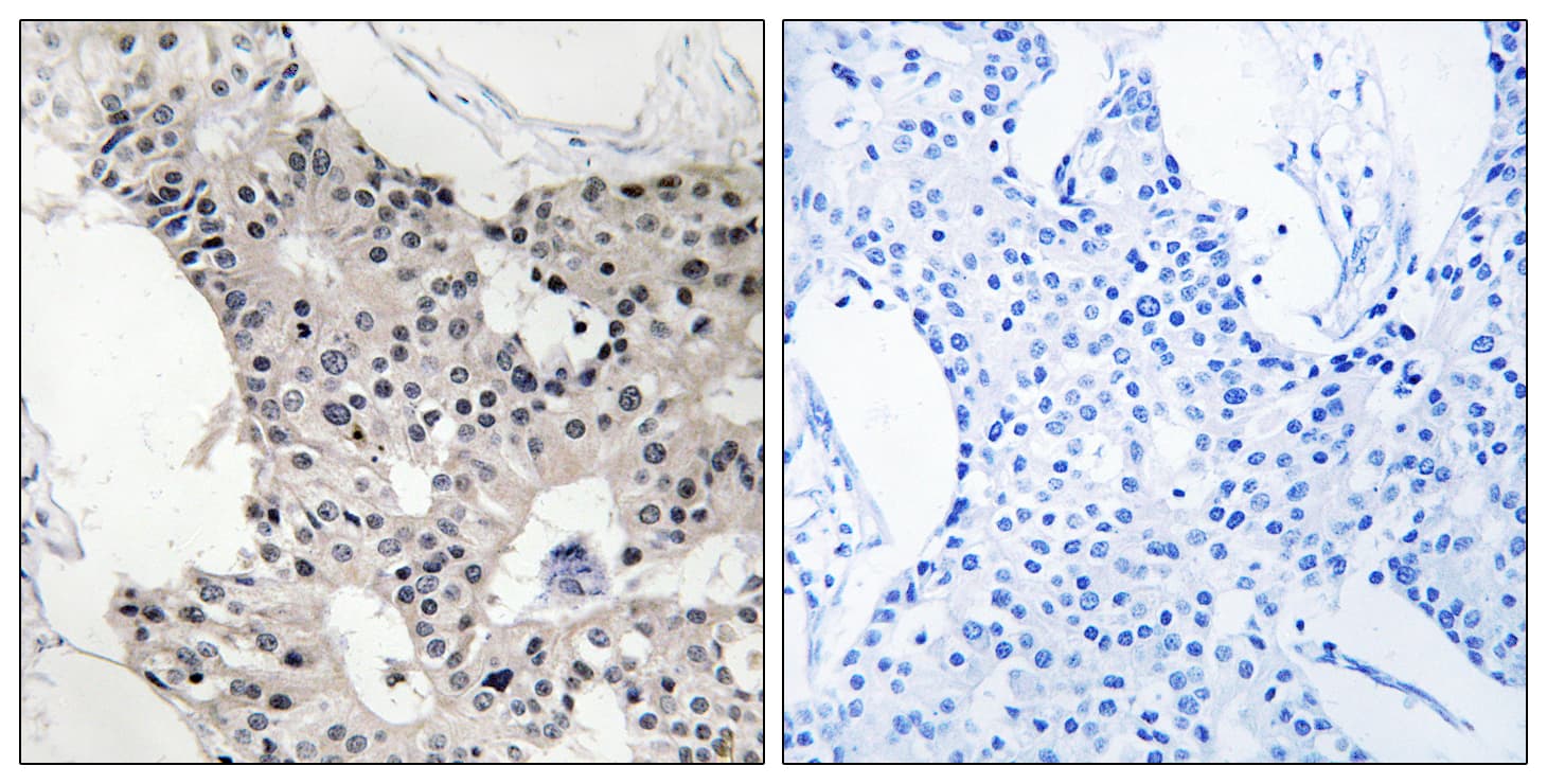 BAGE4 Antibody (aa9-58)