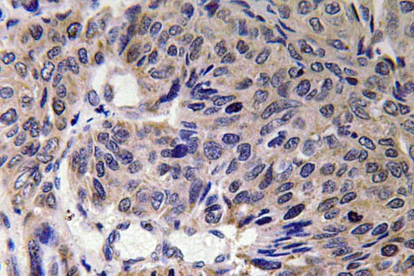 Mitofusin 2 / MFN2 Antibody (aa354-403)