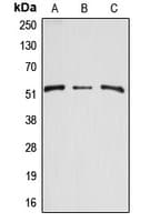ARSA / Arylsulfatase A Antibody (Internal)