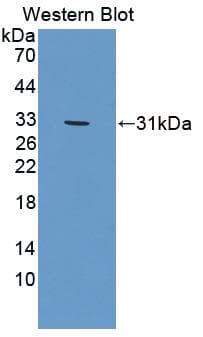 GPAM Antibody (aa594-828)