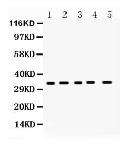 CCS Antibody