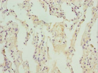 ZBTB48 / HKR3 Antibody