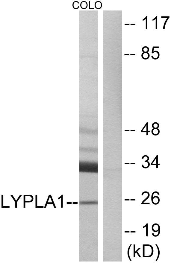 Polyclonal Rabbit anti-Human LYPLA1 Antibody (WB)