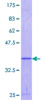 Human OSMR / IL-31R-Beta Protein (Recombinant GST, N-terminus)