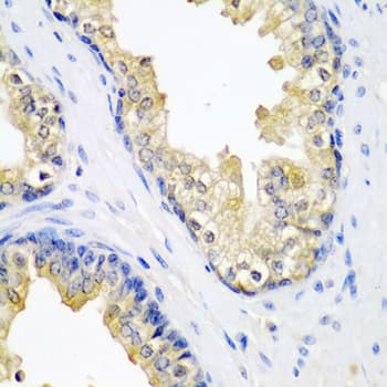 Polyclonal Rabbit anti-Human SPINT2 / HAI-2 Antibody (IHC, IF, WB)