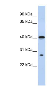 USE1 / p31 Antibody (aa180-229)