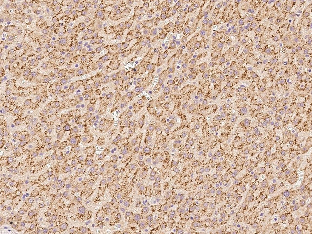 ACBD5 Antibody
