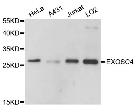 EXOSC4 / RRP41 Antibody