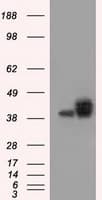 Basigin / Emmprin / CD147 Antibody (clone OTI4E4)