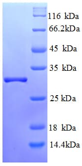 Human ENPEP / Aminopeptidase A Protein (Recombinant His)