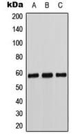 CYP11B1+2 Antibody (N-Terminus)