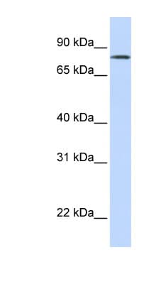 SLCO1B7 Antibody (aa252-301)