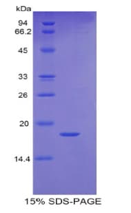 Human RBP5 Protein (Recombinant His)