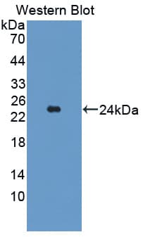 MAP3K7CL / TAK1L Antibody (aa1-142, Biotin)