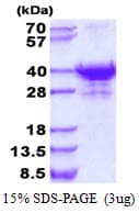 Human UTP23 Protein (Recombinant His)
