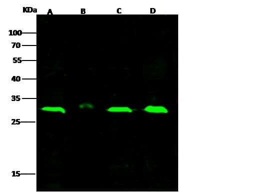 Polyclonal Rabbit anti-Mouse NFKBIB / IKB Beta / IKBB Antibody (Preservative Free, IHC, IF, WB)